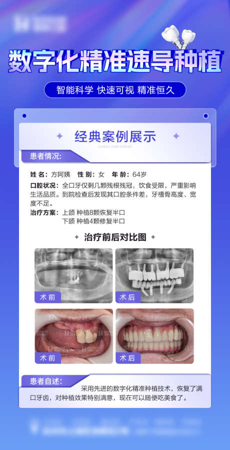 口腔案例海报_源文件下载_PSD格式_750X1465像素-对比,数字化,种植牙,牙齿,海报,案例,口腔-作品编号:2023112916511921-志设-zs9.com