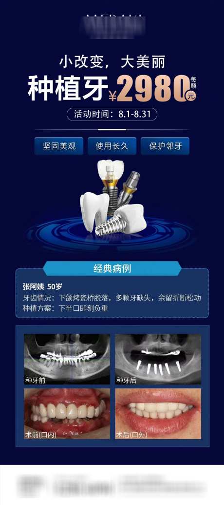 医美整形种植牙海报_源文件下载_PSD格式_1080X2430像素-易拉宝,牙科,换牙-作品编号:2025031313549755-志͵设˯网
