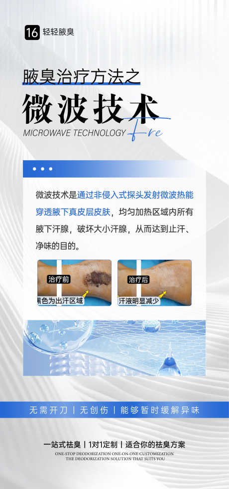 腋臭微波手术海报_源文件下载_AI格式_1080X2300像素-狐臭,腋臭,手术-作品编号:2025092914419399-志,设ˉ网